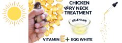 WRY NECK TREATMENT BANNER